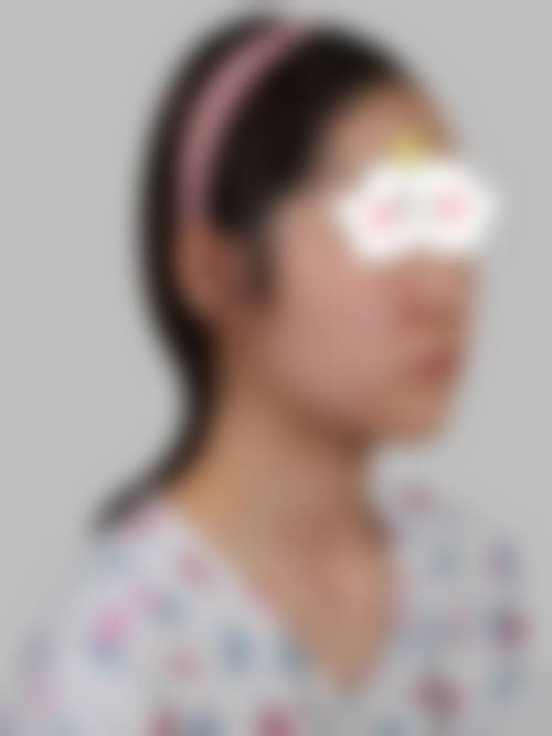 八、杭州颜术悦容医疗美容怎么预约？