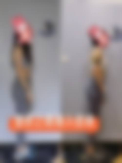 五、烟台韩美美容整形外科收费价格表