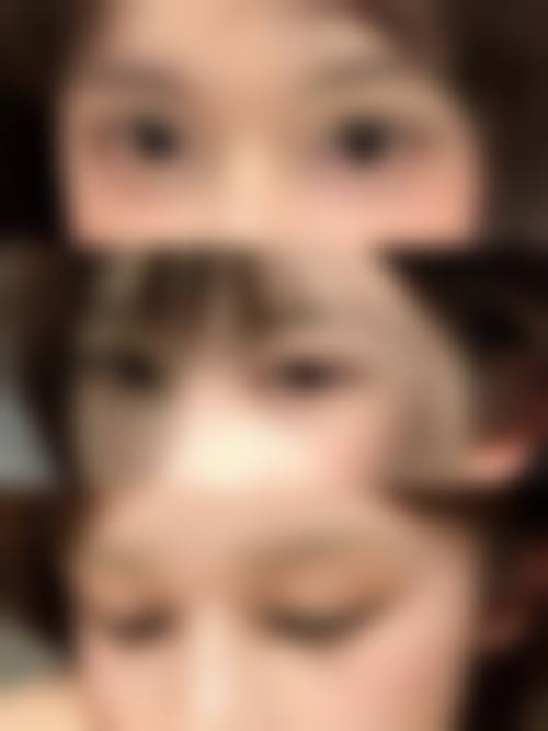 五、乌鲁木齐阳光天使整形医院收费价格表