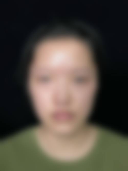 六、泉州石狮柏丽整形美容医院口碑如何?