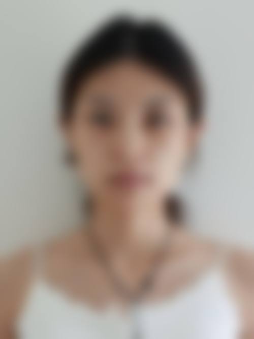 六、合肥医芙莳月时光整形医院口碑如何?