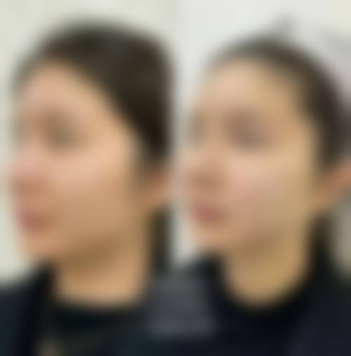 六、乌鲁木齐阳光天使整形医院口碑如何?
