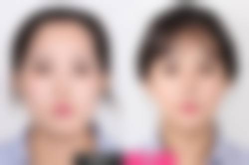 六、北京首玺医学整形医院口碑如何？