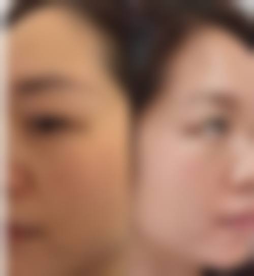 五、北京丁大夫整形医院收费价格表