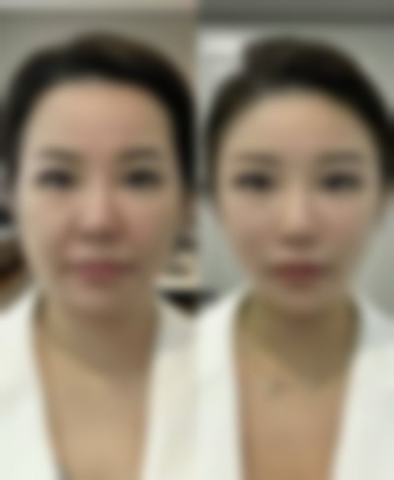 四、杭州颜术悦容周师阳医生坐诊医院