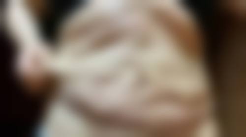 日常预防和保养措施