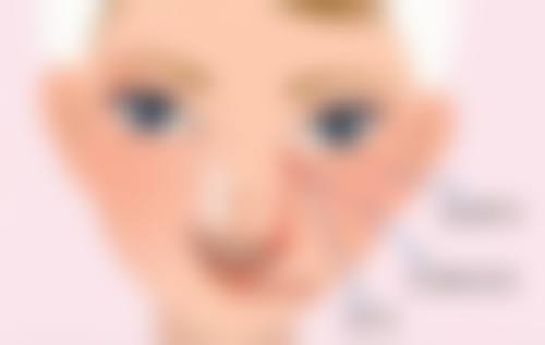 激光治疗眼袋增生