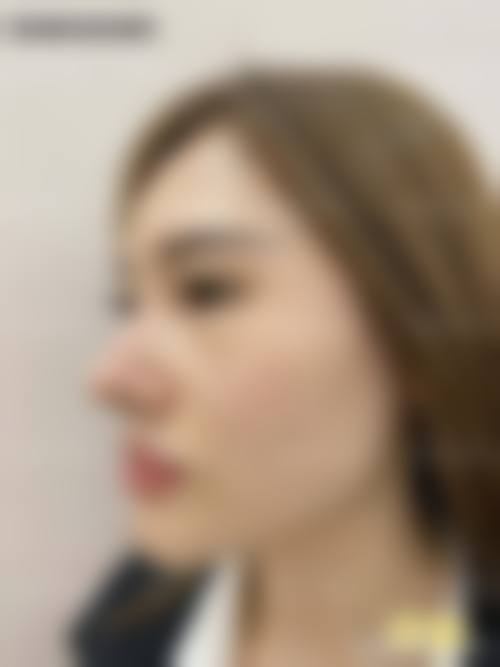四、佳木斯陈红梅医疗美容门诊部特色项目