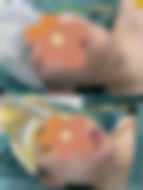 五、昆山赫亿美医疗美容诊所收费价格表
