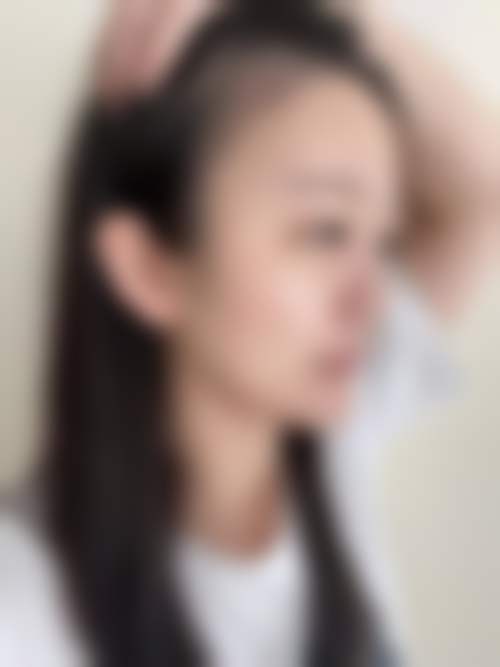 扬州俏华美医疗美容诊所高军飞个人简历和成就：曾任职军区医院，独创缝合技术与特色双眼皮