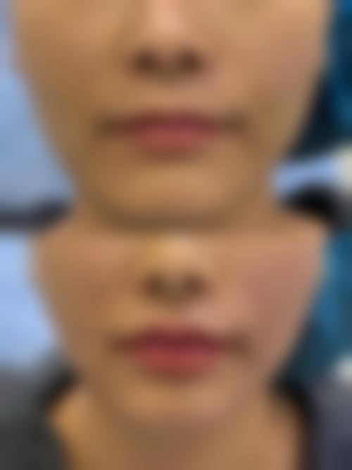 二、樊城区汉辰医疗美容门诊部正规吗?来看医院资质信息