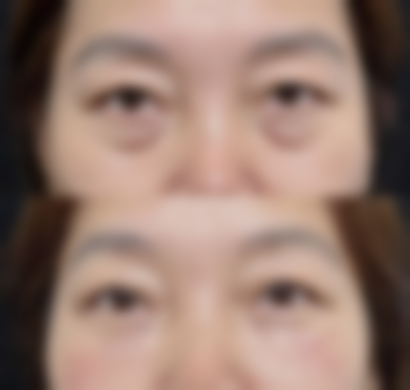 如何正确使用大宝眼袋霜以达到至佳成效