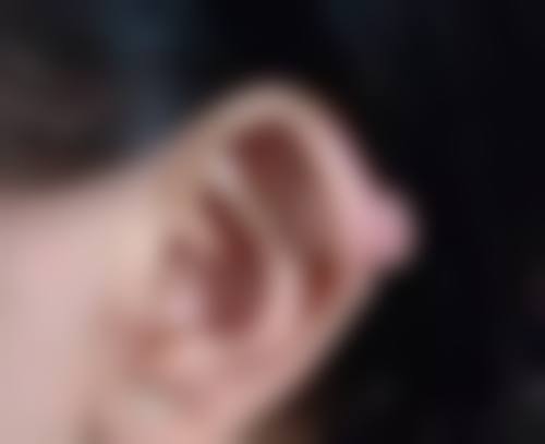 借助医疗医美手段,快速改善眼袋