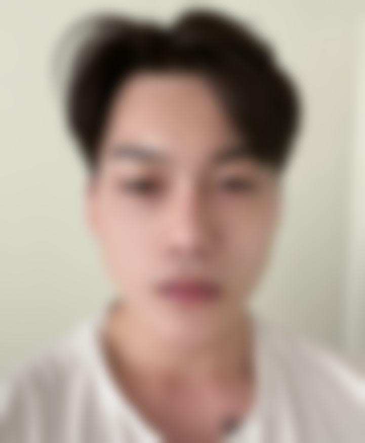 眼部整形真实反馈