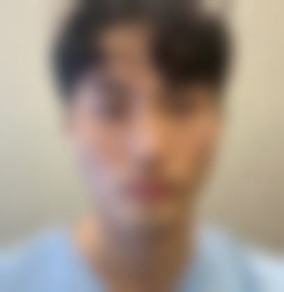 面部轮廓整形真实反馈