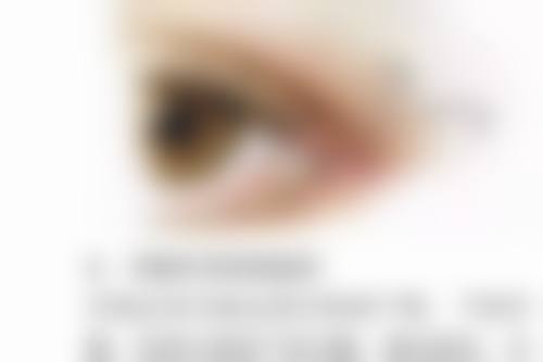 激光治疗:精细效率高的疤痕去除利器