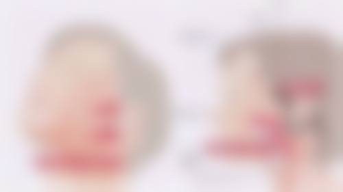 主流观点:做了全切后不建议再做埋线