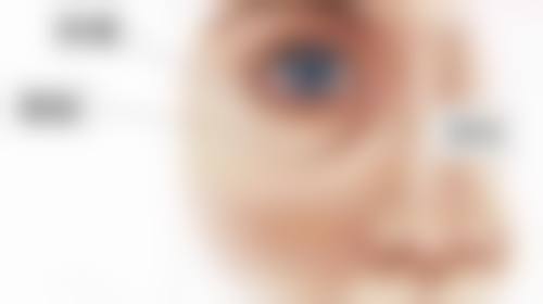 对静态眼纹的治疗