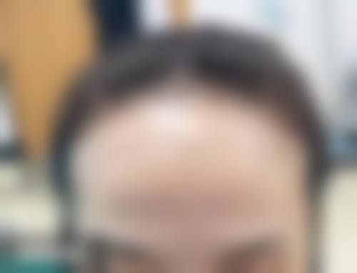 八、绵阳丝缘植发怎么预约?