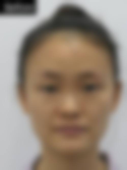 八、广西中 医 药大学附属瑞康医院(整形美容中 心)怎么预约?