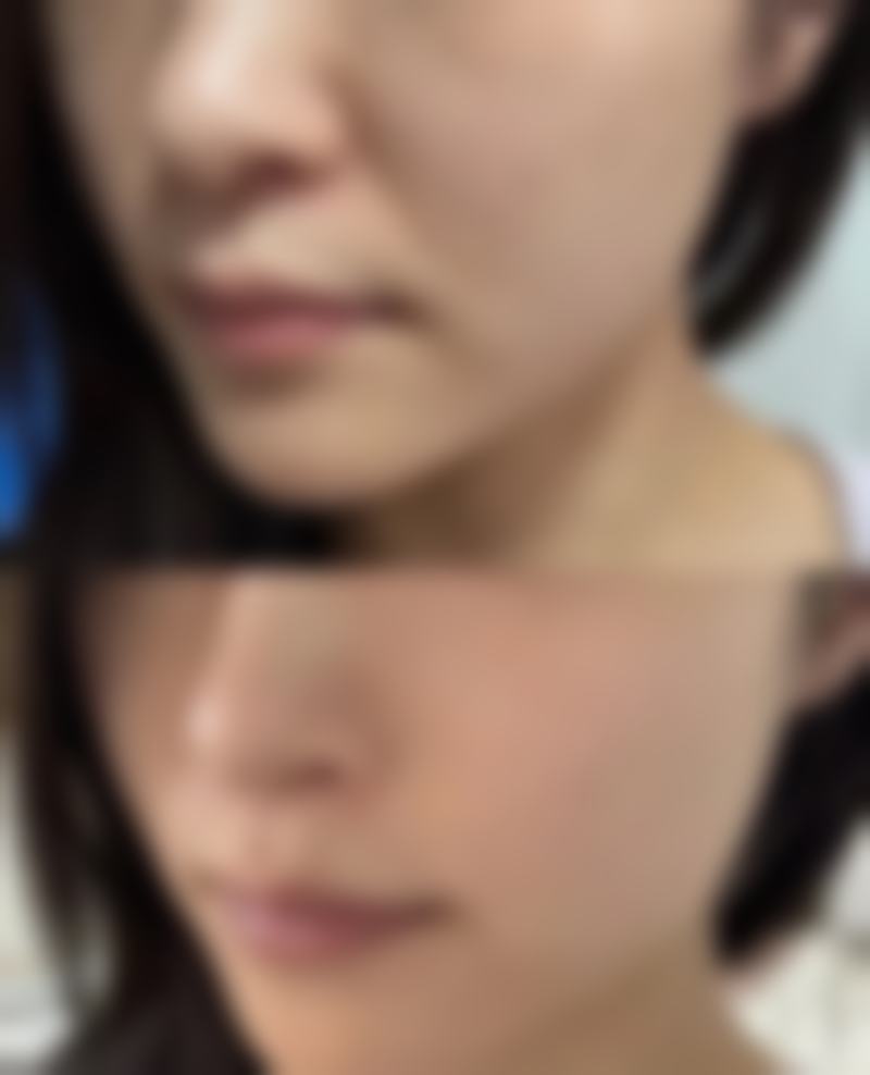 五、三亚唯星颜李卢坤医生技术怎么样?