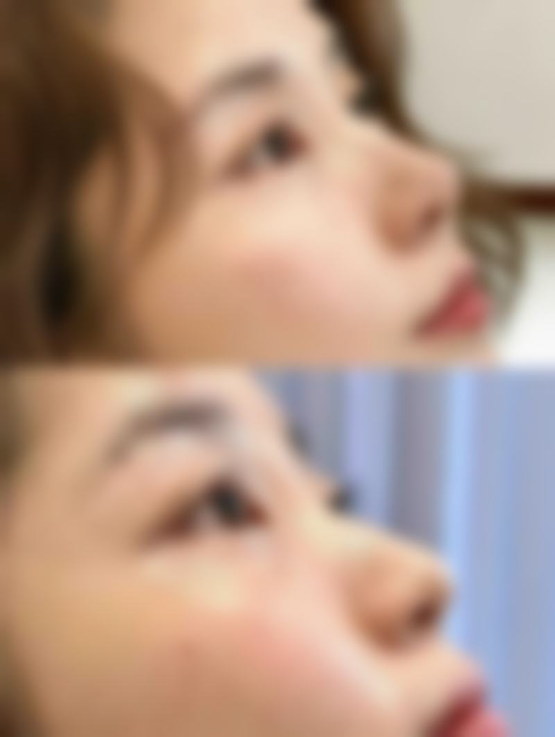六、三亚唯星颜李卢坤医生口碑评价及真人实例反馈