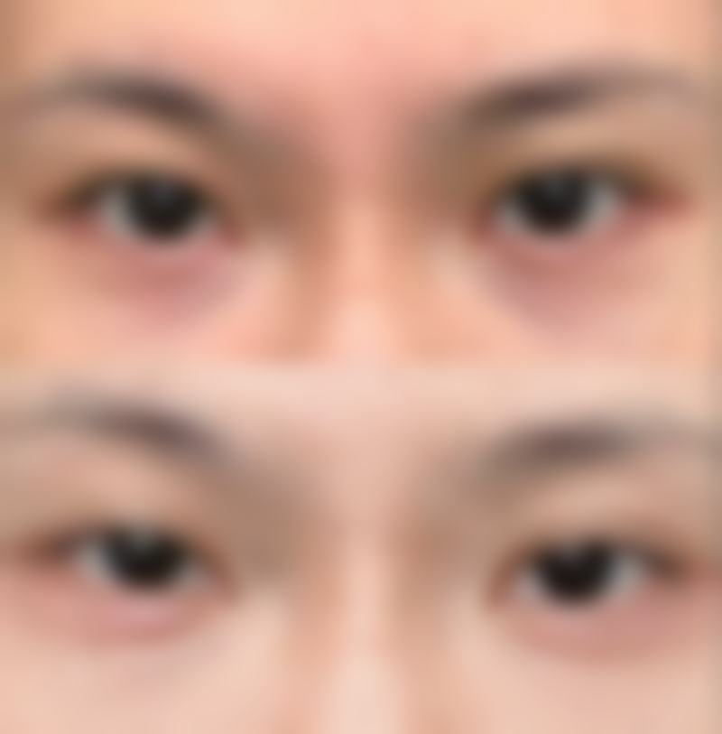 手术前的评估和注意事项