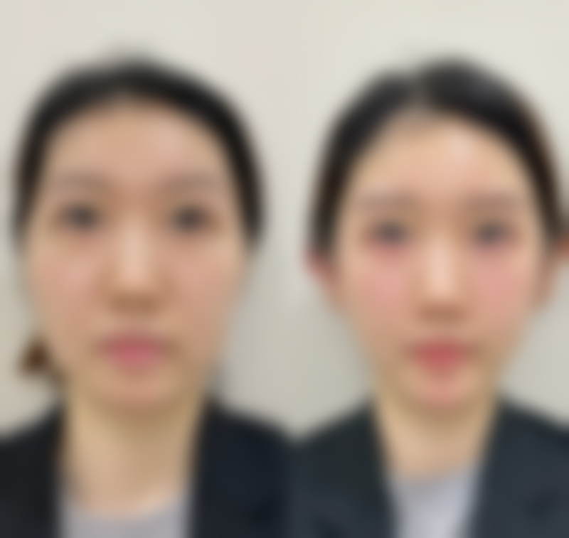 二、乌鲁木齐千禧丽人整形美容康小燕医生擅长项目