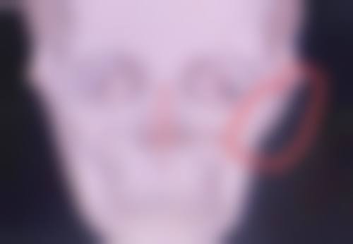 六、韩国blancjou clinic皮肤科口碑如何?