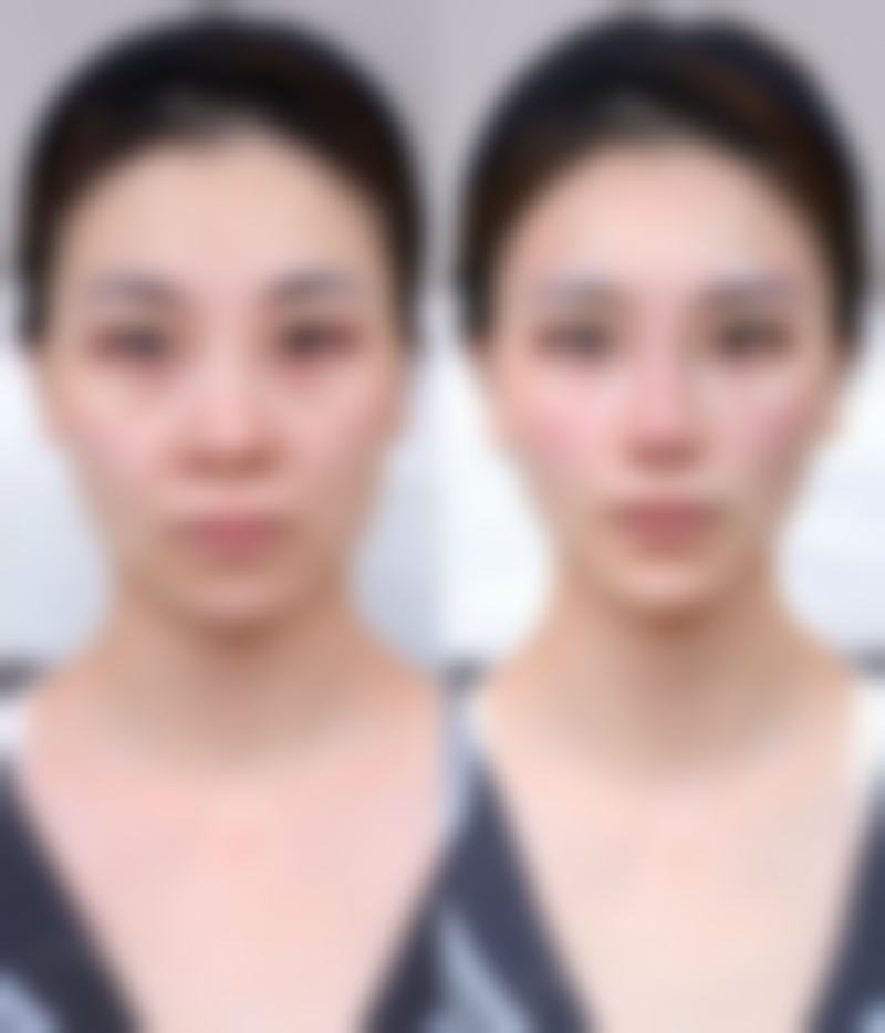 治疗成效与展望