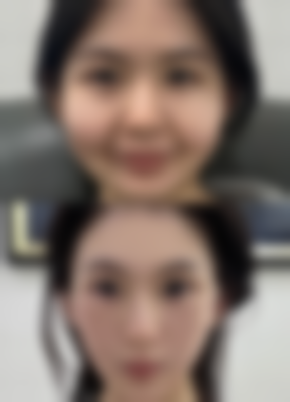 必要时需借助医美改善