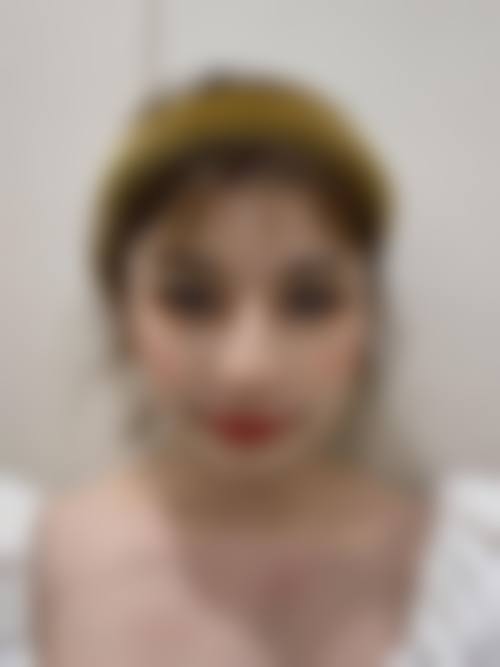 四、韩国好手艺整形医院特色项目