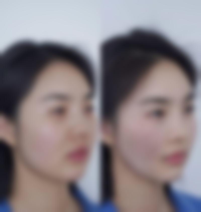 北京伊美尔医疗美容郭海燕医生技术怎么样？