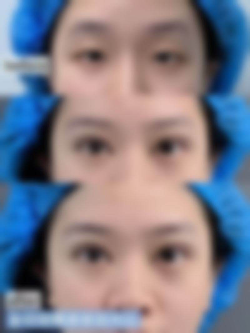 感染隐患