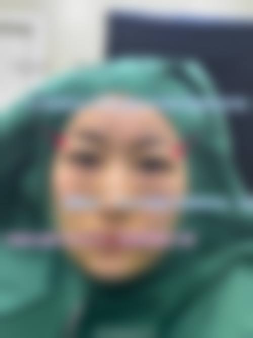 四、镇江韩缇娜整形医院特色项目