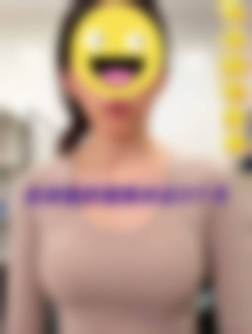 六、东莞莉晨维格整形医院口碑如何？