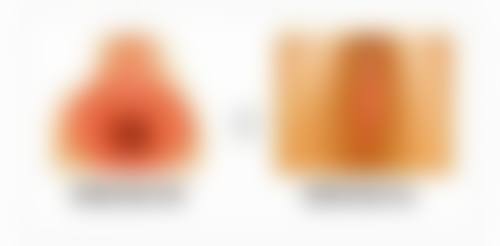 手术隆胸方式：各有千秋，按需选择