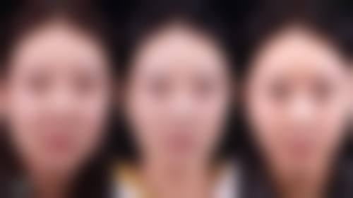 北京丹熙整形罗汇东医生口碑评价及真人实例反馈