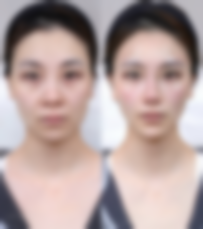 五、亳州缔美医疗整形美容汤芳芳医生技术怎么样?
