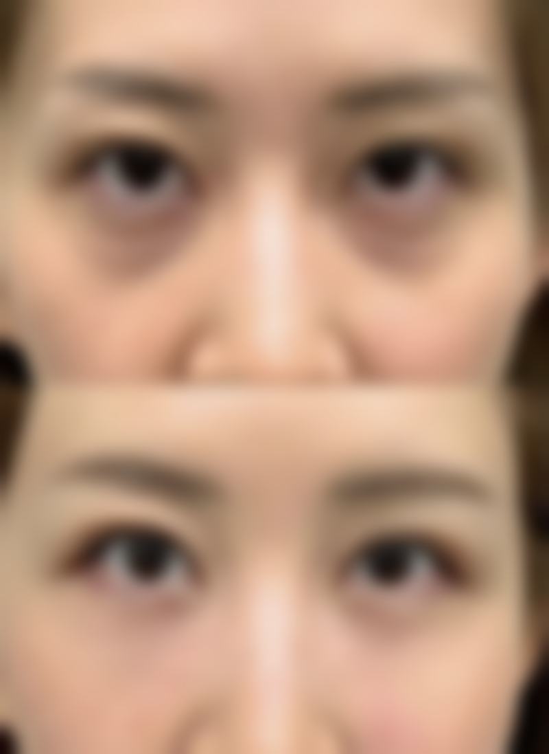 维持时间对比：持久与动态的差别