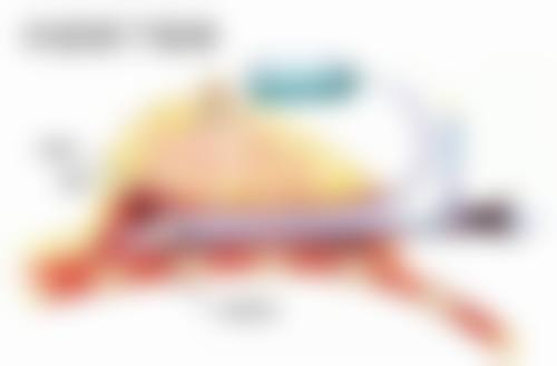 割完双眼皮忌口多久？不同医生建议不同，需结合个人情况，一般1周到半年不等！ 