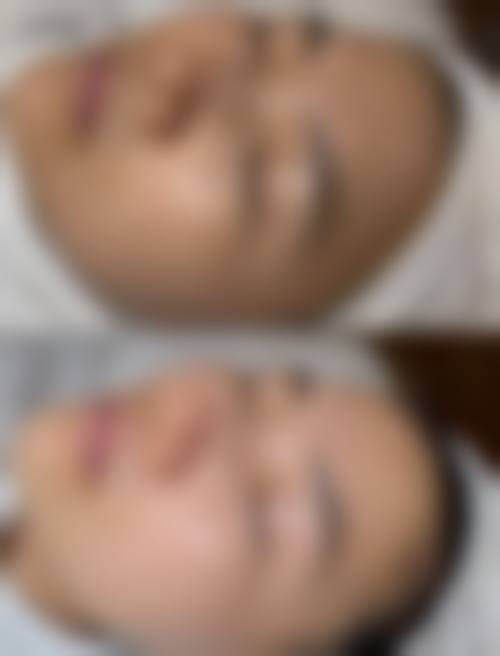 四、芜湖东方美莱坞医疗美容门诊部特色项目