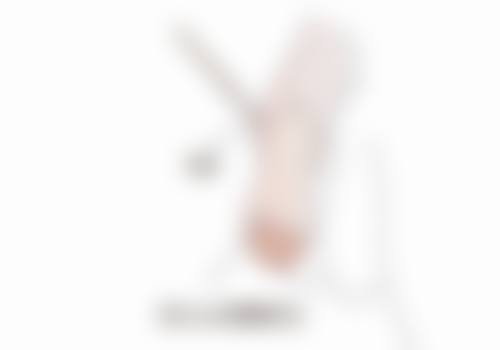 五、无锡臻美医疗美容田洋洲医生技术怎么样?