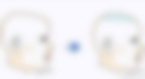 物理治疗:温和手段见成效