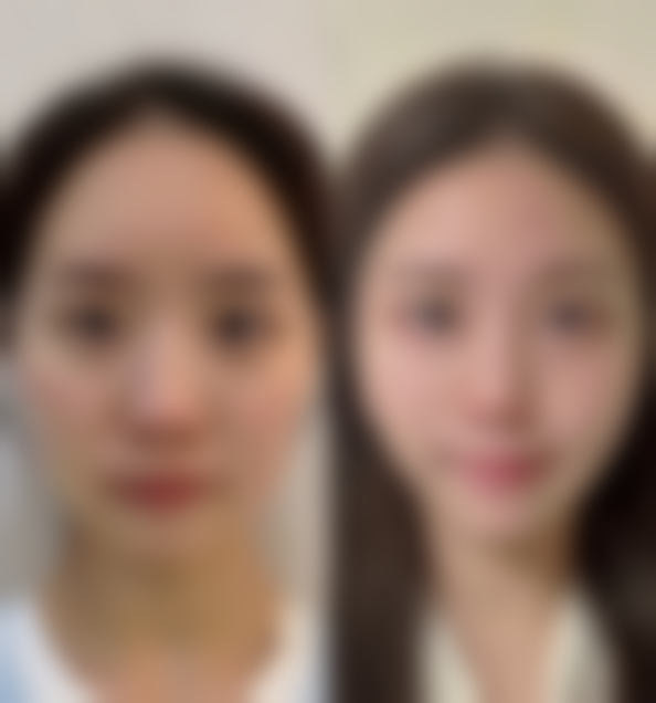 五、乌鲁木齐阳光天使整形姜吉元医生技术怎么样？