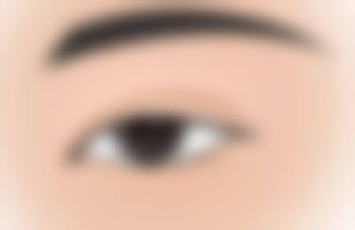 祛疤膏的使用时机和注意事项
