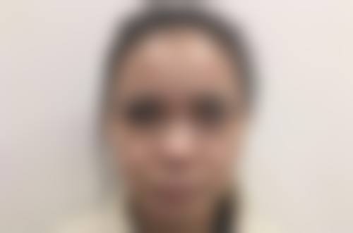 六、贵阳凯丽思整形美容付海燕医生口碑评价及真人实例反馈