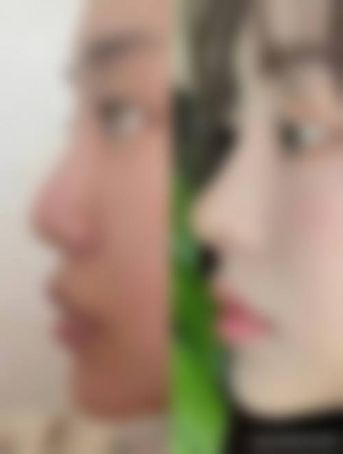 四、韩国DK整形医院特色项目