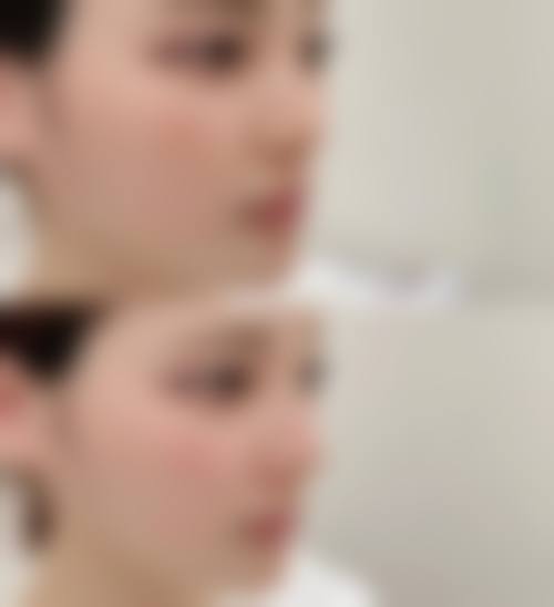 四、常德华美整形美容诊所特色项目