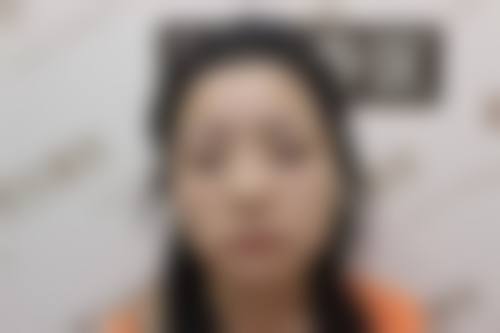 五、广州市天姿医学整形美容门诊部收费价格表